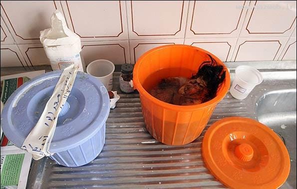 عکس های چندش آور جنینی در شکم یک پسر (16+)