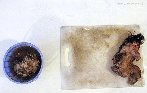 عکس های چندش آور جنینی در شکم یک پسر (16+)