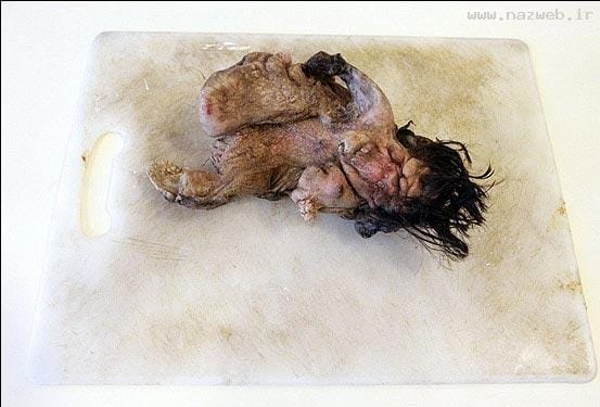 عکس های چندش آور جنینی در شکم یک پسر (16+)