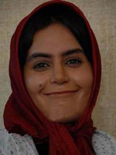 عکس های جنجالی  الناز شاکردوست قبل از عمل زیبایی