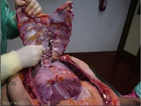 تصاویری از کالبد شکافی بدن زنان و مردان سری اول