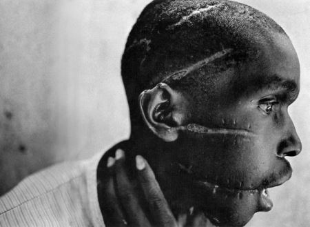 (+18) عکس هایی که یک دنیا درد دارند