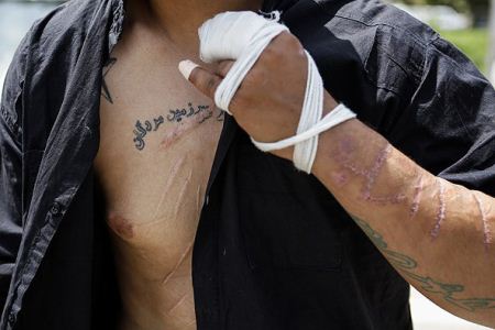 تصاویری از بدن خط خطی اراذل و جاهلین تهران تصاویری از بدن خط خطی اراذل و جاهلین تهران