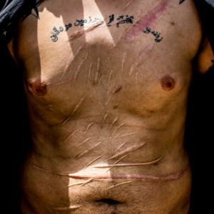 تصاویری از بدن خط خطی اراذل و جاهلین تهران تصاویری از بدن خط خطی اراذل و جاهلین تهران