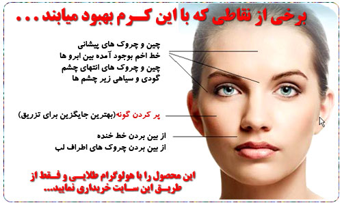 کرم گونه گذار اصل