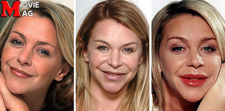 اخبار,اخبار فرهنگی,5 بازیگر که با جراحی پلاستیک چهره شان را از بین بردند! اخبار,اخبار فرهنگی,5 بازیگر که با جراحی پلاستیک چهره شان را از بین بردند!