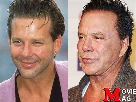 اخبار,اخبار فرهنگی,5 بازیگر که با جراحی پلاستیک چهره شان را از بین بردند! اخبار,اخبار فرهنگی,5 بازیگر که با جراحی پلاستیک چهره شان را از بین بردند!