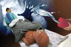رازهای تکاندهنده از زندگی قربانیان ایرانی اسید پاشی + عکس 18 +