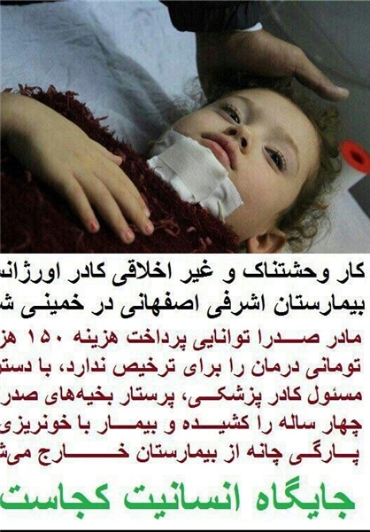 اصل ماجرای بخیه کشیدن کودک اصفهانی چه بود؟ اصل ماجرای بخیه کشیدن کودک اصفهانی چه بود؟