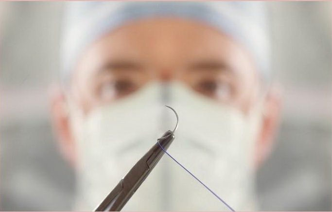 دستور باز کردن بخیه های یک کودک در بیمارستان دولتی/ جراحت بیپولی روی صورت کودک 4 ساله دستور باز کردن بخیه های یک کودک در بیمارستان دولتی/ جراحت بیپولی روی صورت کودک 4 ساله