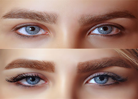 جراحی کاشت ابرو,مراحل کاشت ابرو,عوارض کاشت ابرو