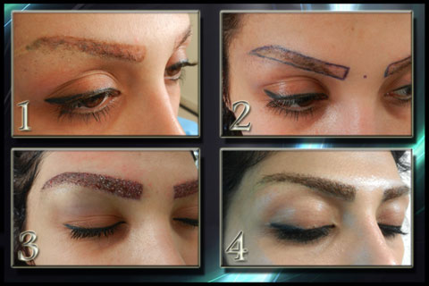 مراکز کاشت ابرو,علل از بین رفتن ابروها,کاشت ابرو