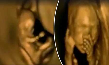 رقص جنین در شکم مادر رقص جنین در شکم مادر