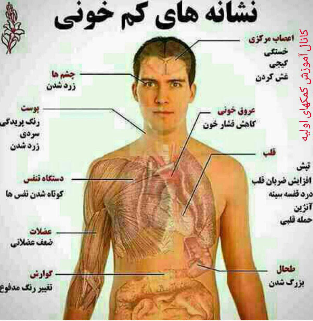 نشانه های کم خونی (عکس)