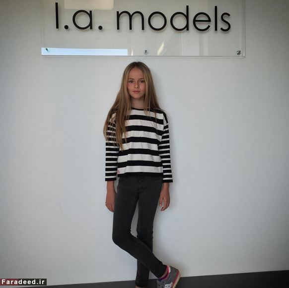 اخبار گوناگون,خبر های گوناگون,زیباترین دختر جهان