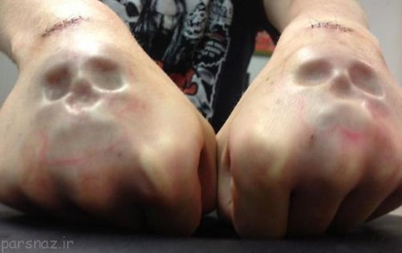 عجیب ترین عمل های جراحی‌ وحشتناک +عکس