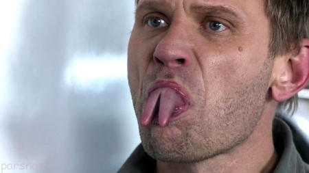 عجیب ترین عمل های جراحی‌ وحشتناک +عکس