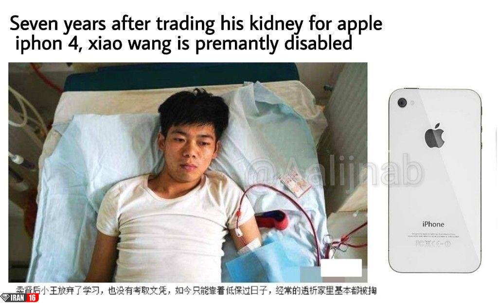 آیفونی که به قیمت دو کلیه تمام شد!