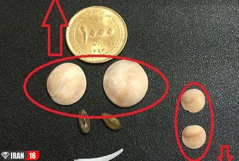 خرید مهره مار اصل هندی و ارزان قیمت