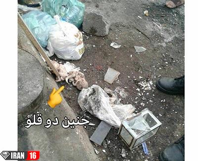انتشار عکس جنین 2 قلوها در زباله های رشت / خیلی تکاندهنده