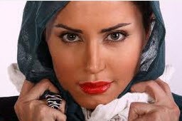 عکس های جنجالی  الناز شاکردوست قبل از عمل زیبایی