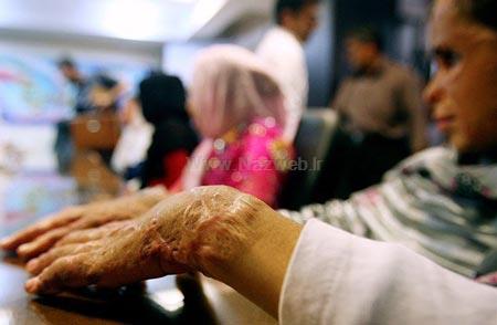 جدیدترین عکس های دختران سوخته ی شین آباد جدیدترین عکس های دختران سوخته ی شین آباد