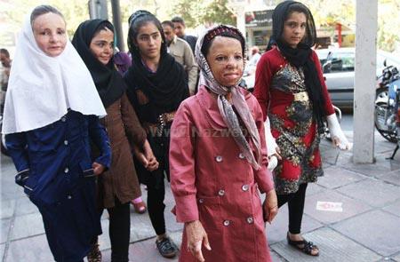 جدیدترین عکس های دختران سوخته ی شین آباد جدیدترین عکس های دختران سوخته ی شین آباد