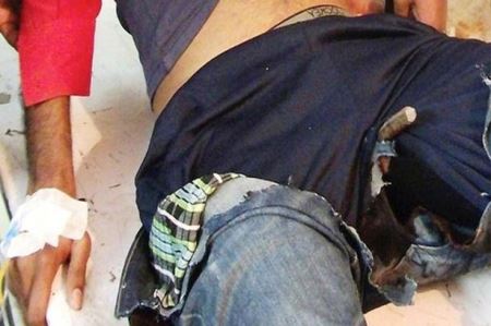 فرو رفتن وحشتناک میله ای در آلت تناسلی این پسر (عکس)