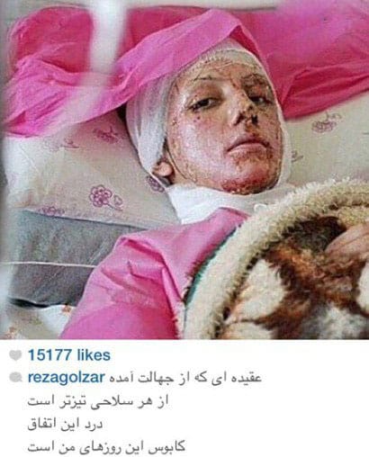 اخبار,اخبار فرهنگی,واکنش متفاوت هنرمندان در صفحات شخصی خود نسبت به اسیدپاشی ها چاخبار,اخبار فرهنگی,واکنش متفاوت هنرمندان در صفحات شخصی خود نسبت به اسیدپاشی ها