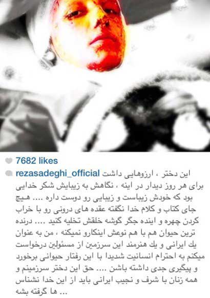 اخبار,اخبار فرهنگی,واکنش متفاوت هنرمندان در صفحات شخصی خود نسبت به اسیدپاشی ها اخبار,اخبار فرهنگی,واکنش متفاوت هنرمندان در صفحات شخصی خود نسبت به اسیدپاشی ها