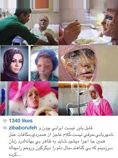 اخبار,اخبار فرهنگی,واکنش متفاوت هنرمندان در صفحات شخصی خود نسبت به اسیدپاشی ها اخبار,اخبار فرهنگی,واکنش متفاوت هنرمندان در صفحات شخصی خود نسبت به اسیدپاشی ها