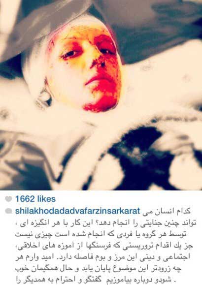 اخبار,اخبار فرهنگی,واکنش متفاوت هنرمندان در صفحات شخصی خود نسبت به اسیدپاشی ها اخبار,اخبار فرهنگی,واکنش متفاوت هنرمندان در صفحات شخصی خود نسبت به اسیدپاشی ها