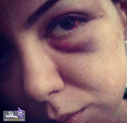 ماجرای بستری شدن آزاده نامداری از زبان وکیلش,دعوای آزاده نامداری و فرزاد حسنی