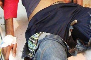 فرو رفتن وحشتناک میله ای در آلت تناسلی این پسر (عکس)