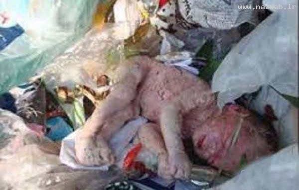 16+ عکس های سقط جنین زیر زمینی