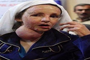 جدیدترین عکس های دختران سوخته ی شین آباد