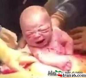 تولد نوزاد , عکس زایمان سزارین , عکس زایمان سزارین انسان , تصاویر به دنیا آمدن بچه , به دنیا آمدن نوزاد , جراحی زایمان سزارین