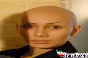 سرتراشیده بازیگران زن