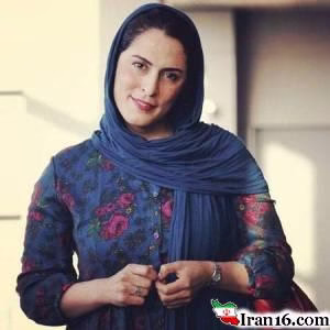 بیماری ام اس در بازیگران مشهور