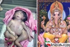 نوزاد , نوزاد عجیب الخلقه , نوزاد عجیب و غریب , عکس نوزاد عجیب الخلقه , خدای هندی