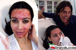 skinrejuvenationstrangewayscelebrities