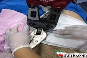 بزرگ کردن آلت تناسلی آقایان با حلقه جنسی +عکس