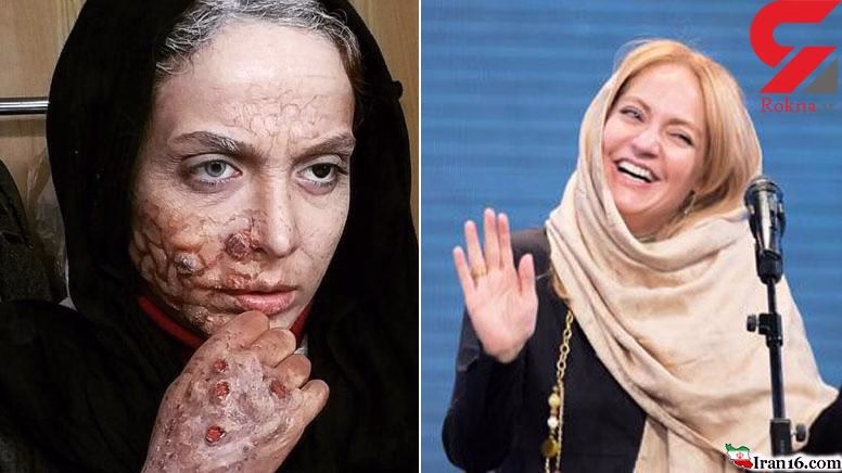 عکس سوپر استار زن مشهور با گریم زامبی (14+)