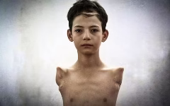 فرهاد مجیدی ,مرگ ,قطع دست ,پروتز ,بیمارستان سوانح و سوختگی ,علی هاتفی ,برق گرفتگی