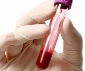 خون گیری مشترک از دختران یک دبیرستان در تاکستان