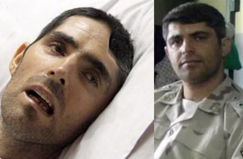 لحظه مجروح شدن شهید سید نورخدا موسوی