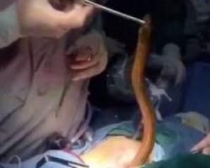 خارج-شدن-مار-از-شکم