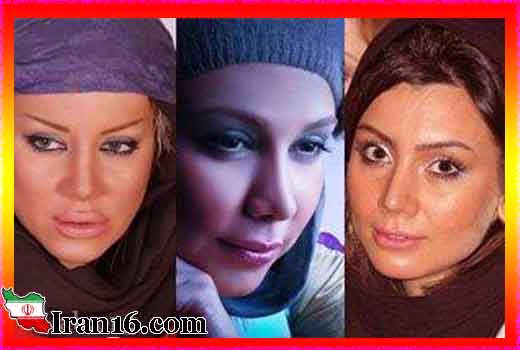 عکس های لورفته بازیگران زن ایرانی قبل عمل زیبایی