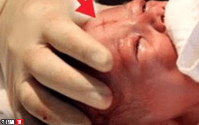 شگفت زده شدن مردم از تولد نوزادی با یک نشانه+ عکس