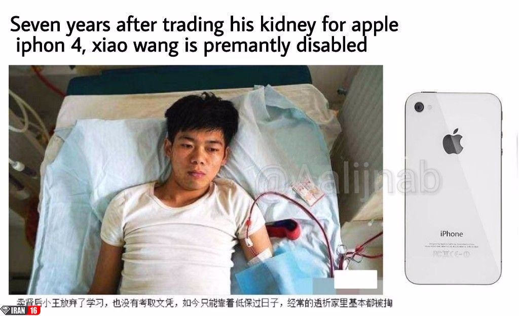 آیفونی که به قیمت دو کلیه تمام شد!